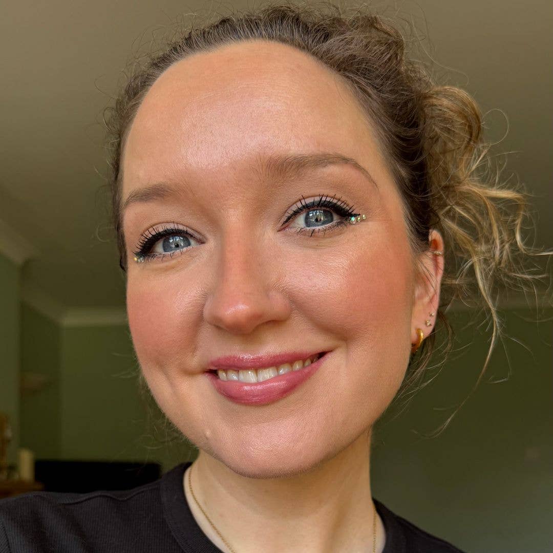 I've had rosacea for 8 years - here's how I finally banished it
